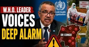 منظمة الصحة العالمية تطلق إرشادات جديدة لتعزيز علاج فيروس إيبولا وماربورج في مواجهة التحديات الصحية الراهنة