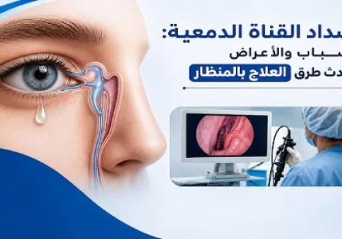 انسداد القناة الدمعية: تعرف على الأسباب والأعراض وأحدث تقنيات العلاج بالمنظار